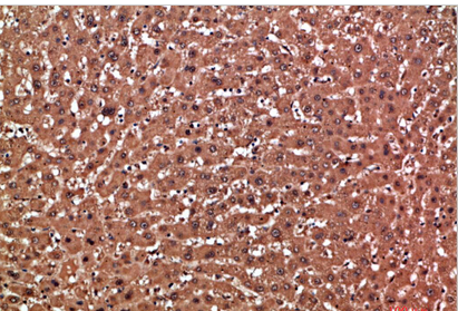 GSTA1 Polyclonal Antibody