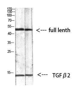 TGFβ2 Polyclonal Antibody