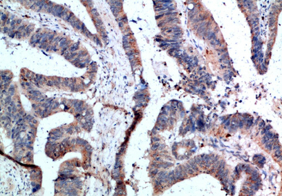 APRIL Polyclonal Antibody