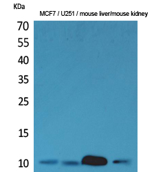 ACBP Polyclonal Antibody