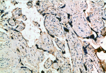 Inhibin α Polyclonal Antibody