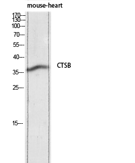 Cathepsin B Polyclonal Antibody