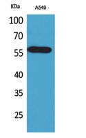 ALDH2 Polyclonal Antibody