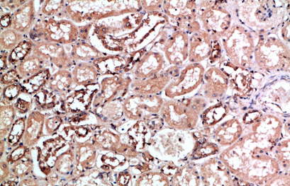 CD158f1/2 Polyclonal Antibody