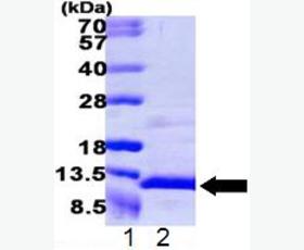 Recombinant Human Mothers Against Decapentaplegic Homolog 2/SMAD2