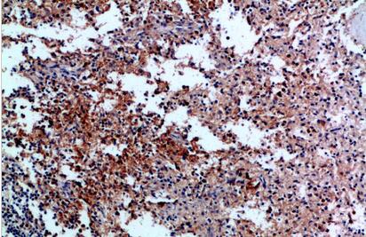 CD42c Polyclonal Antibody