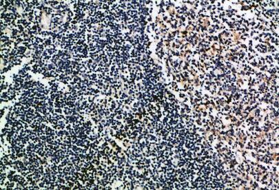 CD52 Polyclonal Antibody