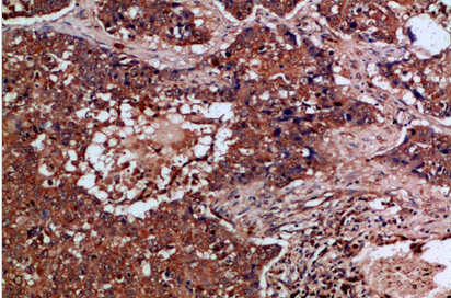 Flt-4 Polyclonal Antibody