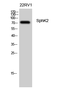 SphK2 Polyclonal Antibody