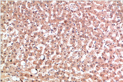 EPG5 Polyclonal Antibody