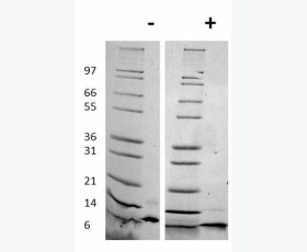 Recombinant Human Tissue Inhibitor of Metalloproteinases 1/TIMP-1