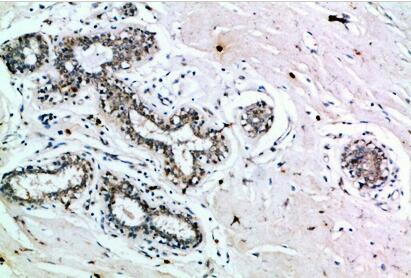 Insulin R Polyclonal Antibody