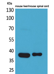 Aldolase C Polyclonal Antibody