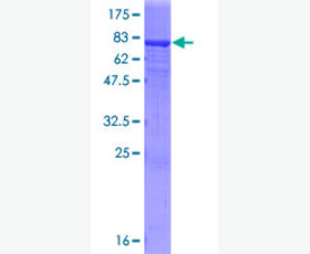 Recombinant Human Fibroblast Growth Factor 8/FGF-8e