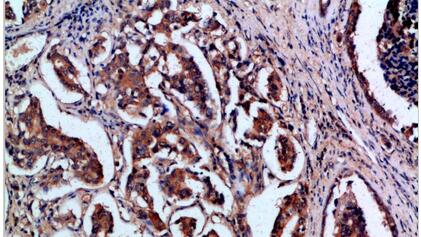 OPN Polyclonal Antibody