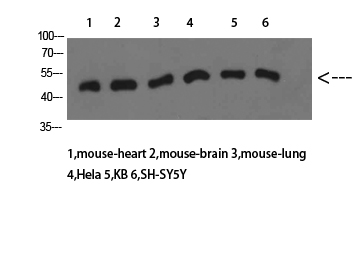 PTEN Polyclonal Antibody