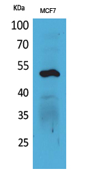 Cytokeratin 14 Polyclonal Antibody