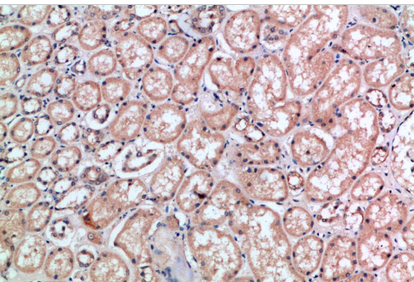 CD300e Polyclonal Antibody