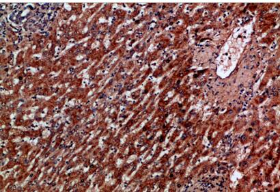 IL-8RA Polyclonal Antibody