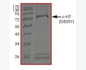 Recombinant Mouse C-X-C Motif Chemokine 1/CXCL1/GRO α