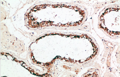 PACAP Polyclonal Antibody