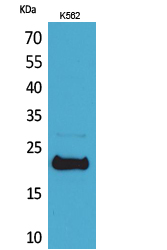 LIF Polyclonal Antibody