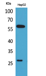 GGT1 Polyclonal Antibody