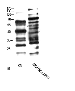 Pan myristoylation Polyclonal Antibody