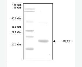 Recombinant Human Death Domain-Containing Protein CRADD/CRADD