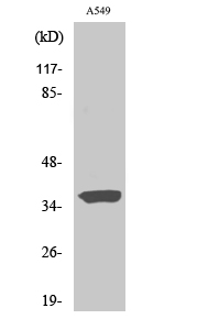 STEAP1 Polyclonal Antibody