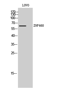 ZNF460 Polyclonal Antibody