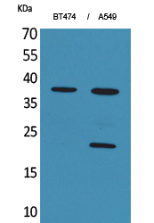 IFN-α1 Polyclonal Antibody