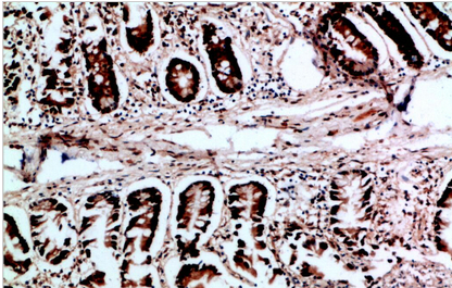 VHL Polyclonal Antibody