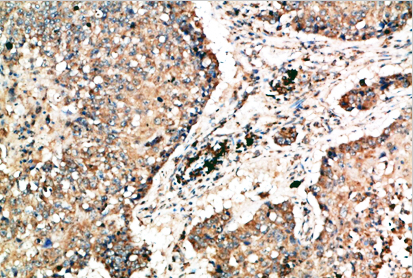 Napsin A Polyclonal Antibody