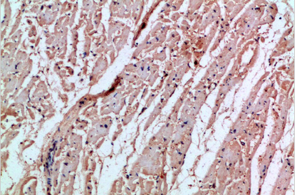 MIA Polyclonal Antibody