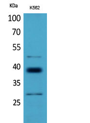 CD1D Polyclonal Antibody