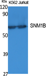 SNM1B Polyclonal Antibody