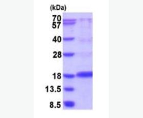 Recombinant Mouse GITR/TNFRSF18/CD357