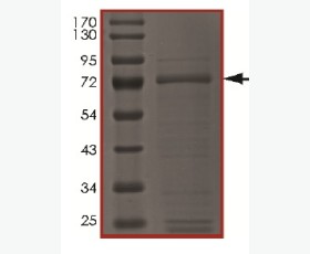 Recombinant Human N-myc Downstream Regulated Gene 1/NDRG1/DRG-1CAP43