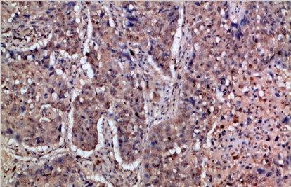 IFN-α/βRα Polyclonal Antibody