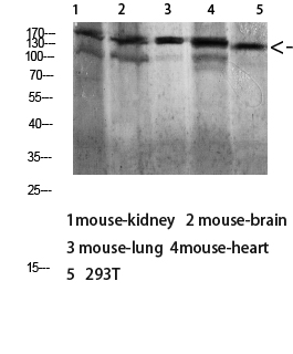 Dsg1 Polyclonal Antibody