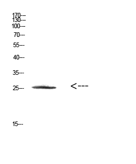 HSP27 Polyclonal Antibody