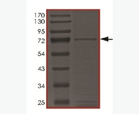 Recombinant Human 6-Phosphogluconate Dehydrogenase, Decarboxylating/PGD