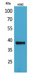 CD1C Polyclonal Antibody