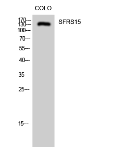 SFRS15 Polyclonal Antibody