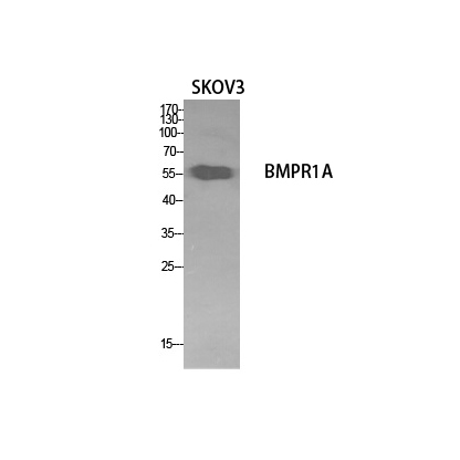 CD292 Polyclonal Antibody