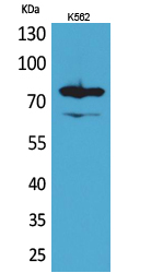 FOXP1 Polyclonal Antibody