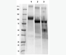 Recombinant Human Heat Shock Protein β-11/HSPB11