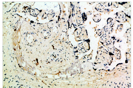 Ob Polyclonal Antibody