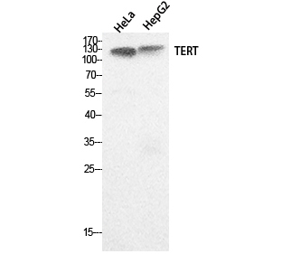 TERT Polyclonal Antibody